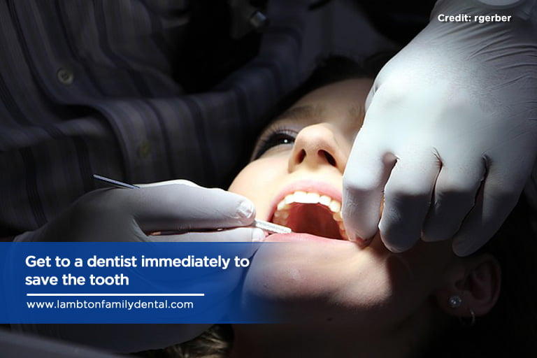 Get to a dentist immediately to save the tooth
