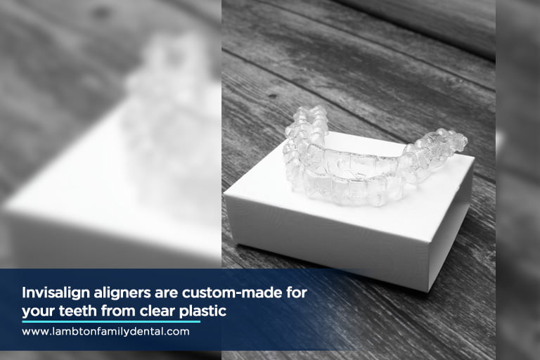 Invisalign aligners are custom-made for your teeth