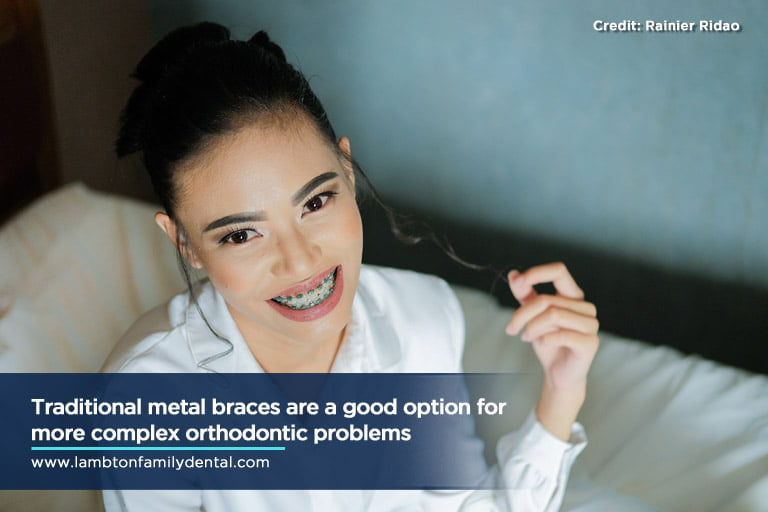 Traditional metal braces are a good option