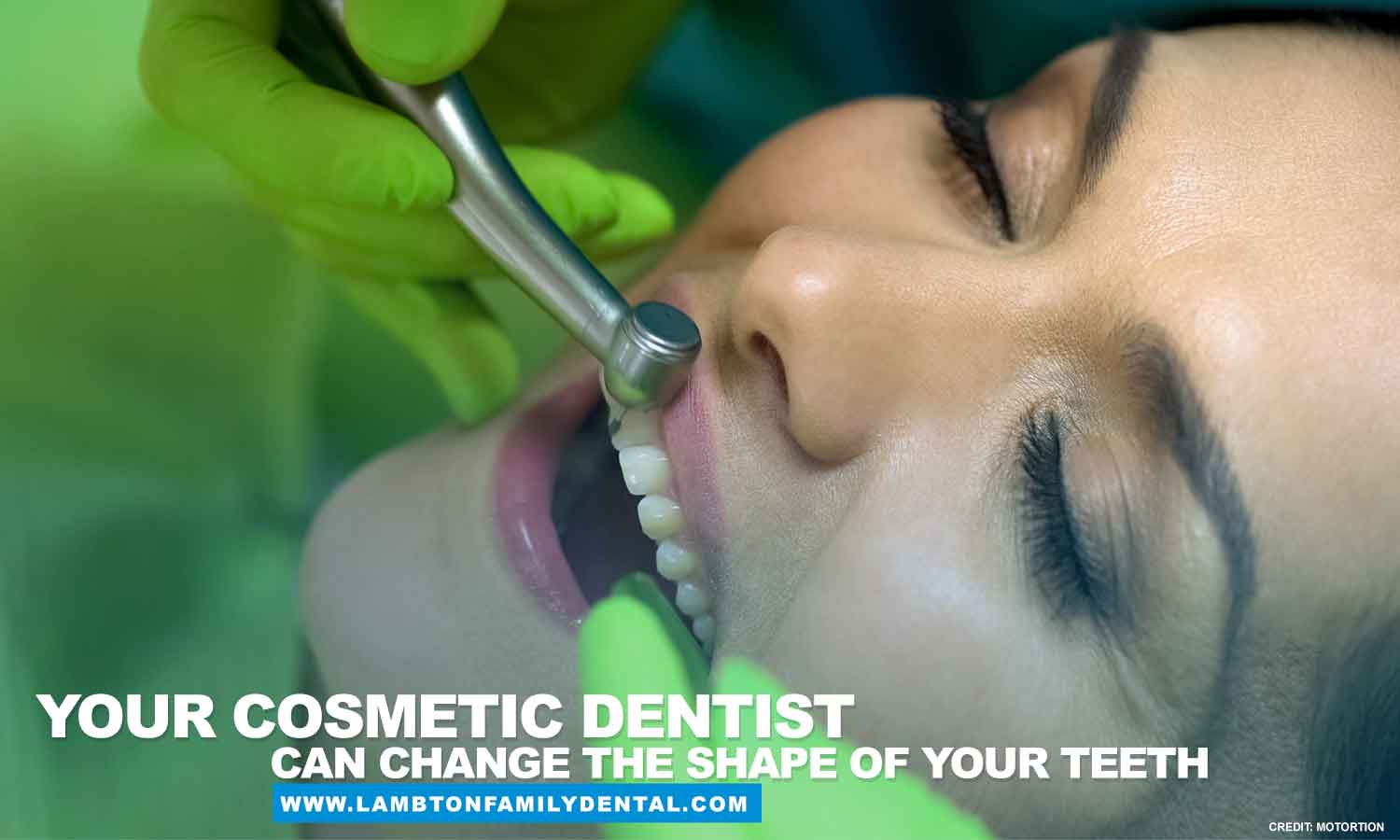 cosmetic dentist can change the shape of your teeth
