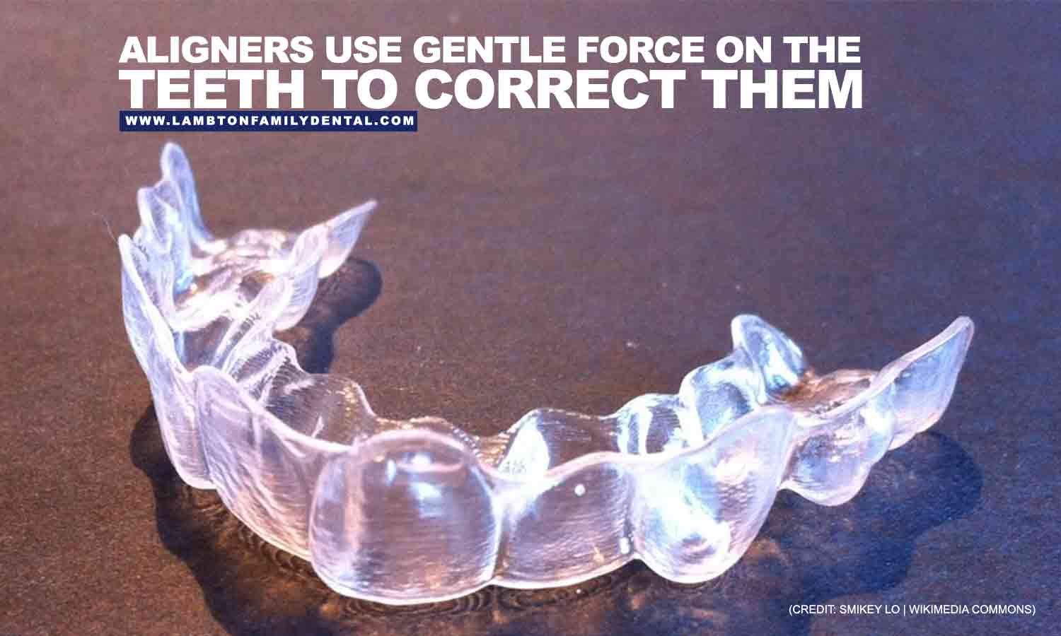 Aligners use gentle force