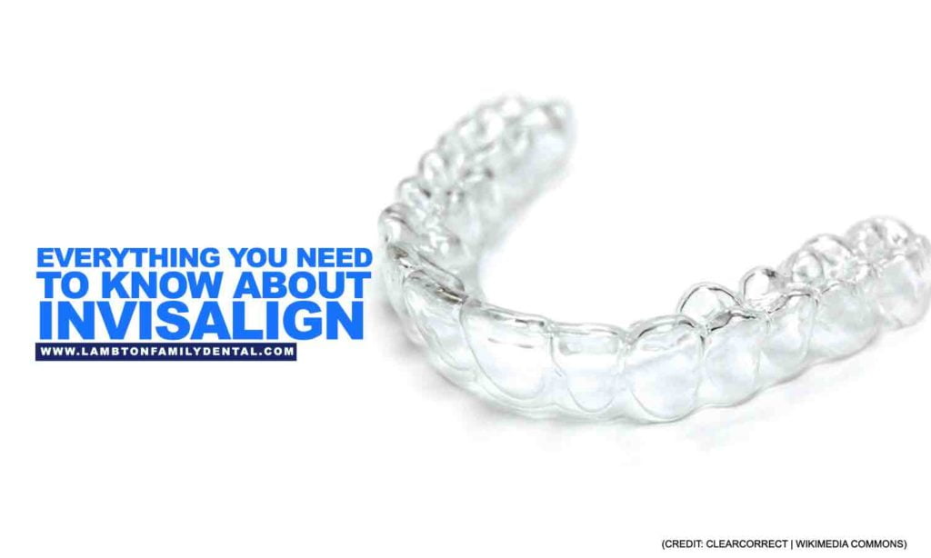 Everything You Need to Know About Invisalign | Lambton Family Dental