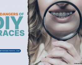 The Dangers of DIY Braces