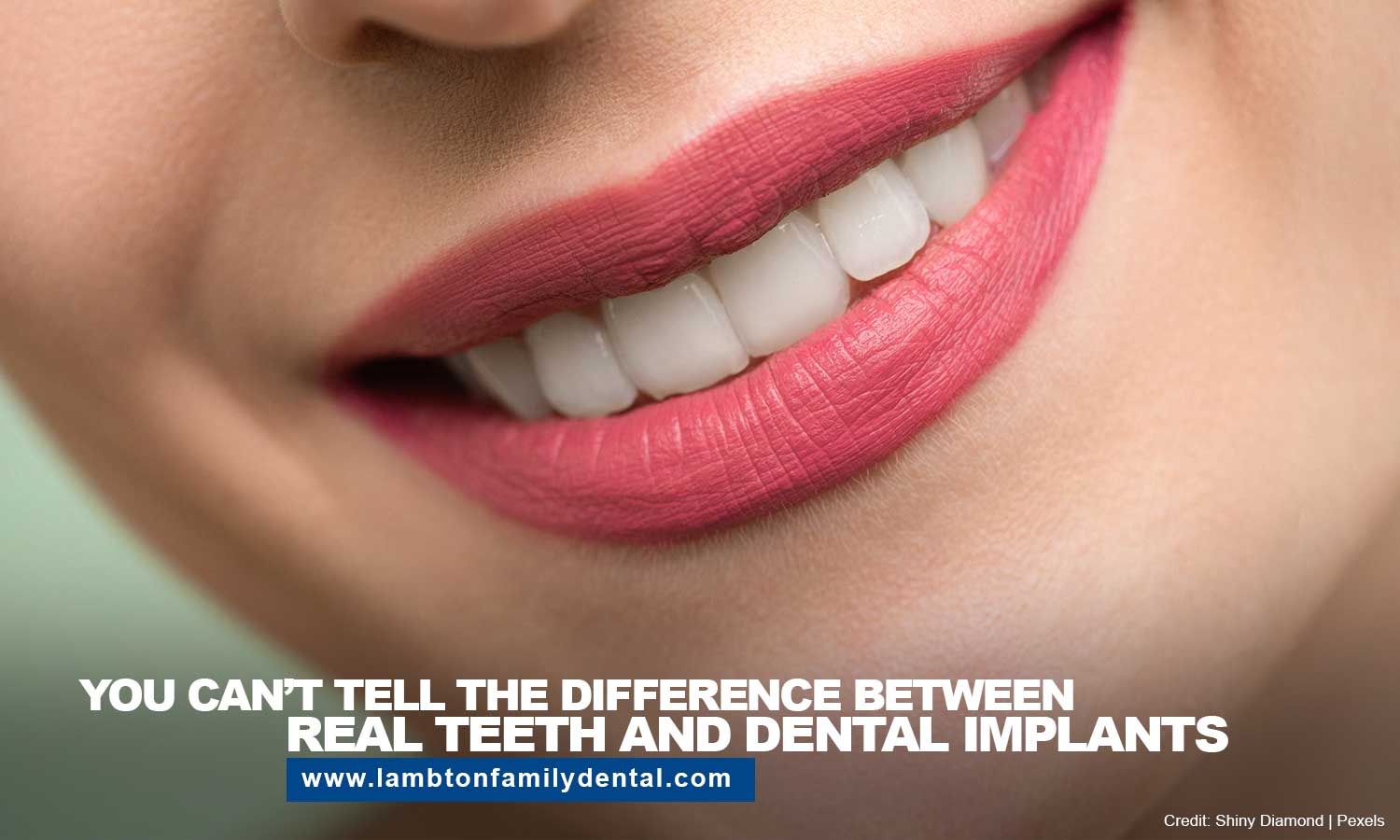 difference between real teeth and dental implants