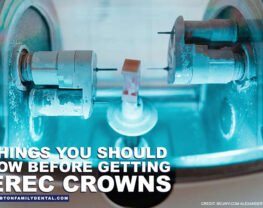 6-Things-You-Should-Know-Before-Getting-CEREC-Crowns-opt