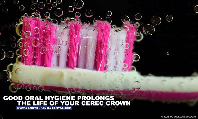 Good-oral-hygiene-prolongs-the-life-of-your-CEREC-crown-opt