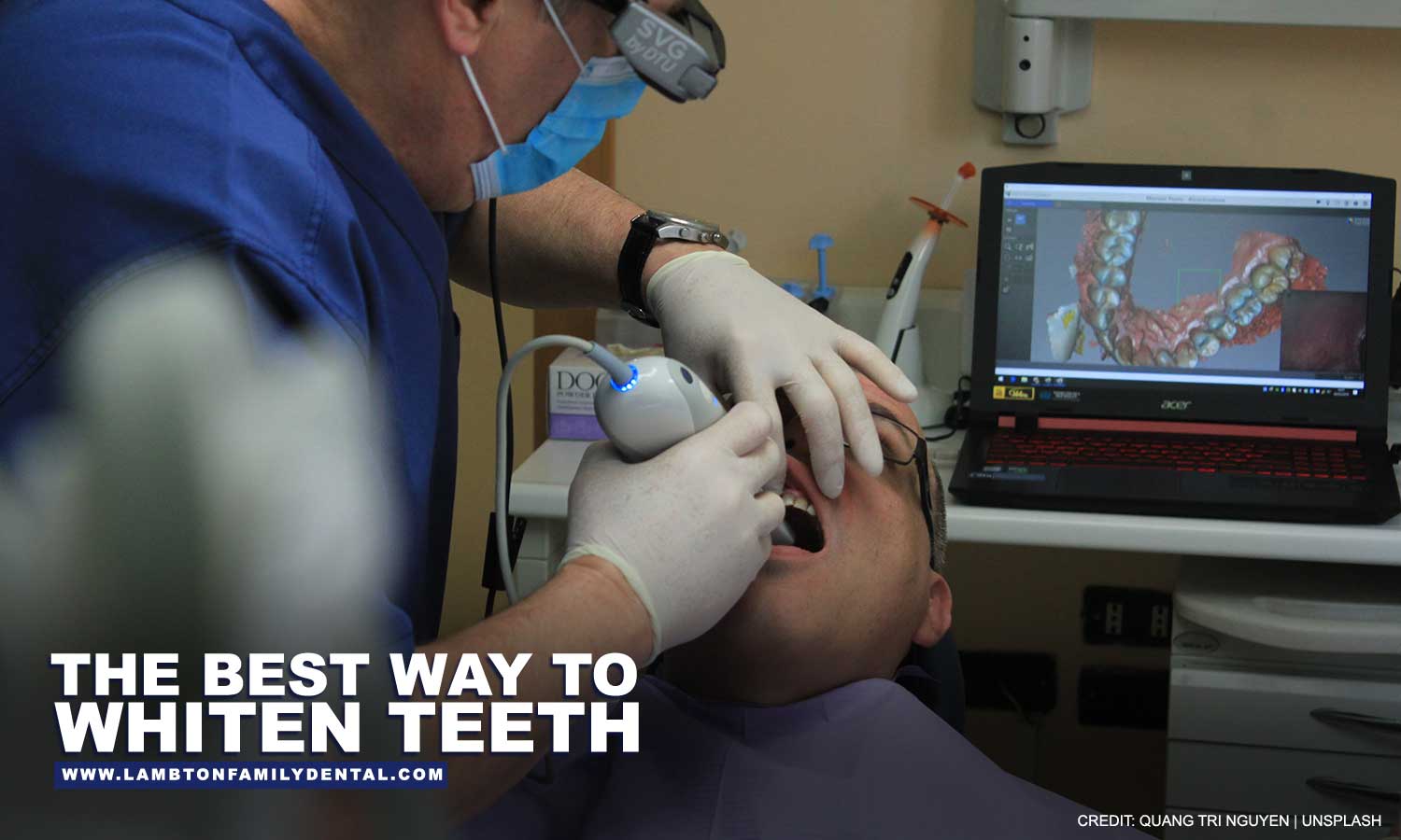 best way to whiten teeth