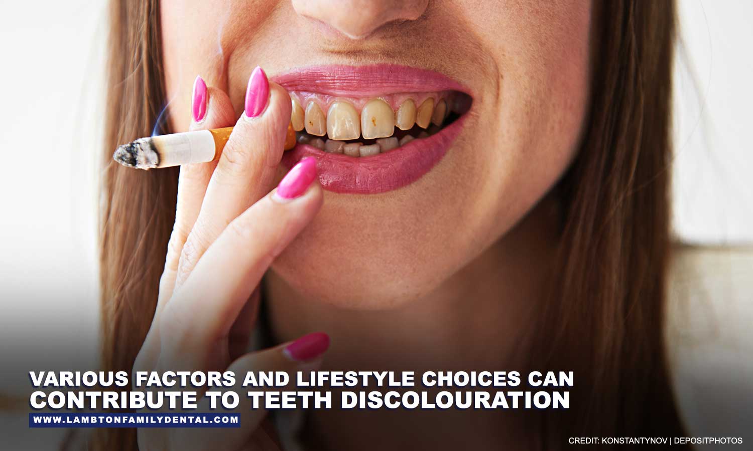 Various factors and lifestyle