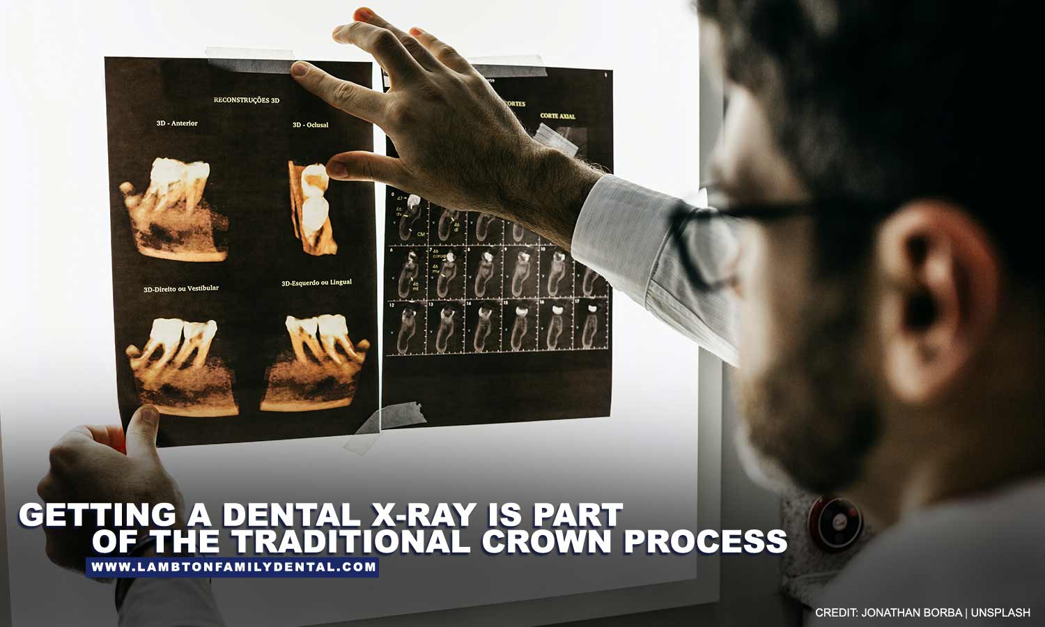 Getting a dental x-ray