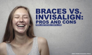 Braces vs. Invisalign: Pros and Cons