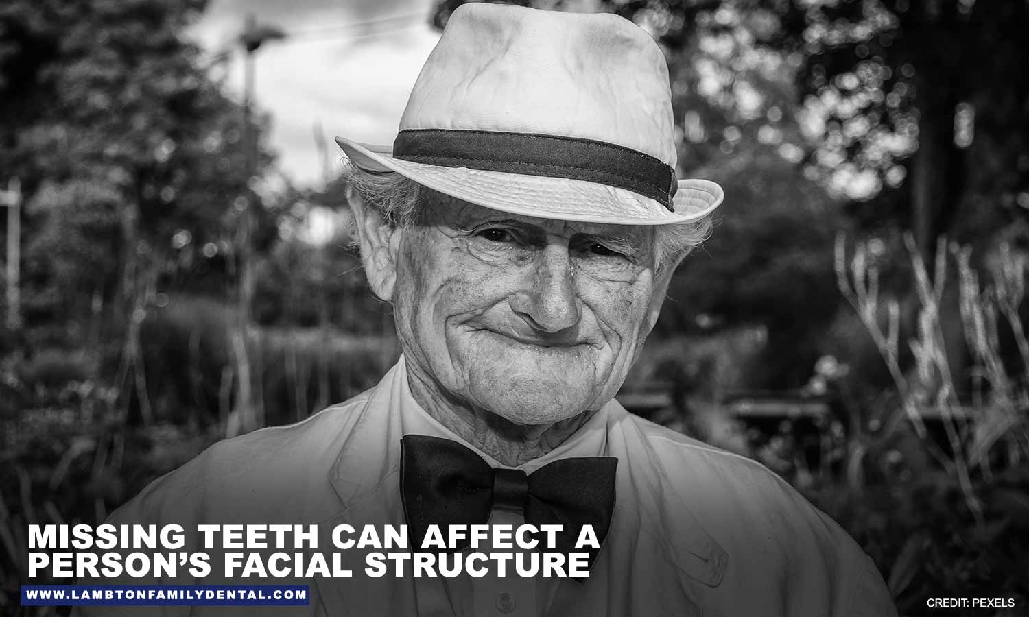 Missing teeth can affect a person’s facial structure