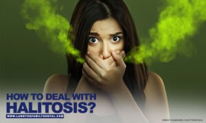 How to Deal With Halitosis?
