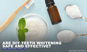 Are DIY Teeth Whitening Safe and Effective?