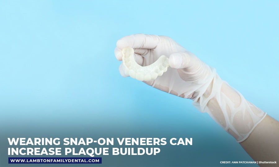 Wearing snap-on veneers can increase plaque buildup