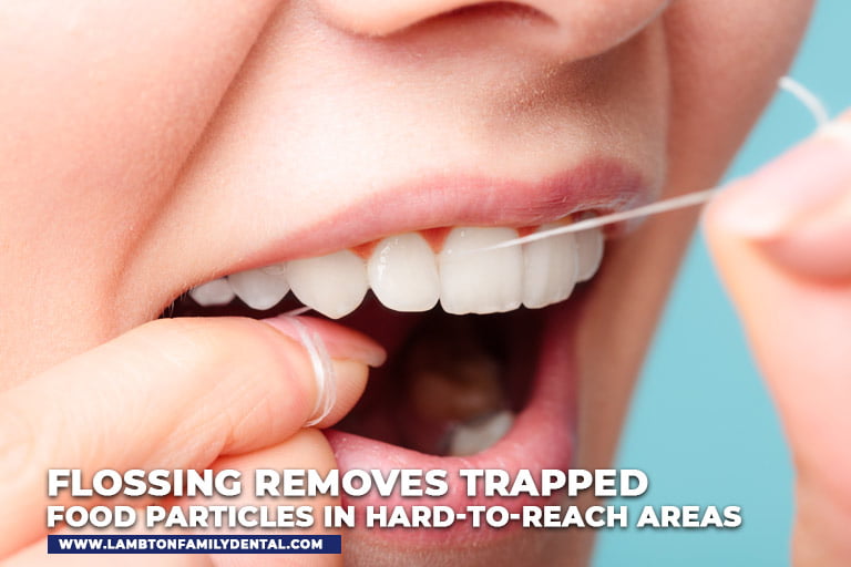 Flossing removes trapped food particles in hard-to-reach areas