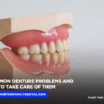 7 Common Denture Problems and How to Take Care of Them