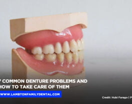 7 Common Denture Problems and How to Take Care of Them