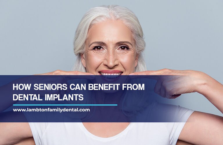 How Seniors Can Benefit From Dental Implants