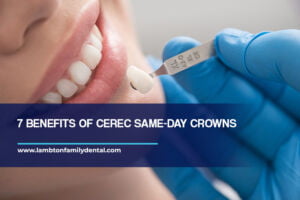 7 Benefits of CEREC Same-Day Crowns