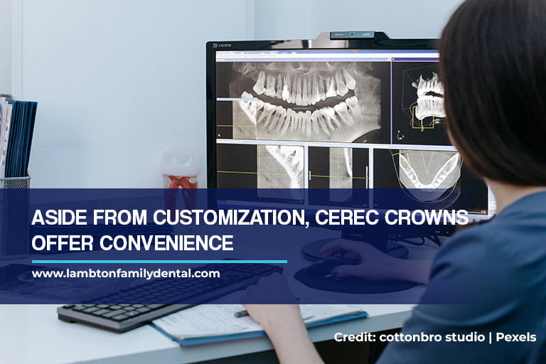 Aside from customization, CEREC crowns offer convenience