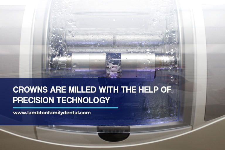 Crowns are milled with the help of precision technology