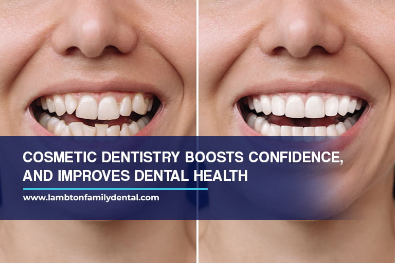 Cosmetic dentistry boosts confidence, and improves dental health