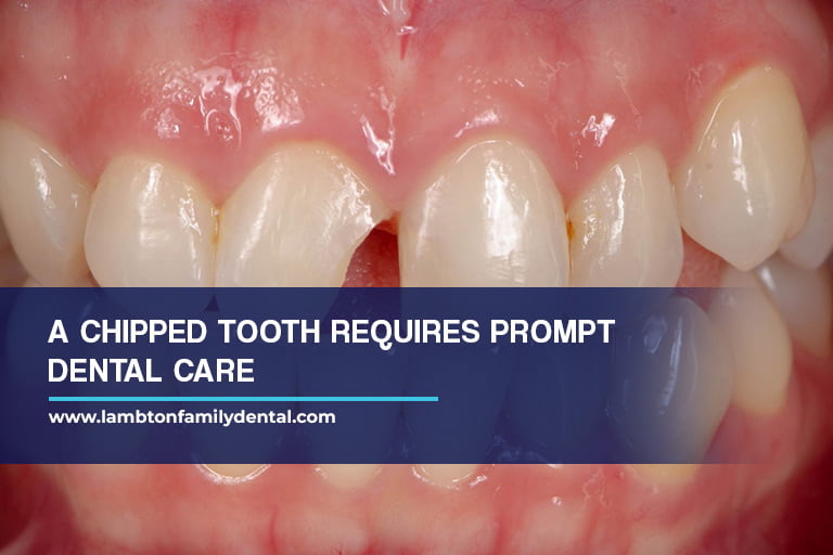 A chipped tooth requires prompt dental care