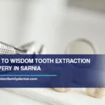Guide to Wisdom Tooth Extraction Recovery in Sarnia