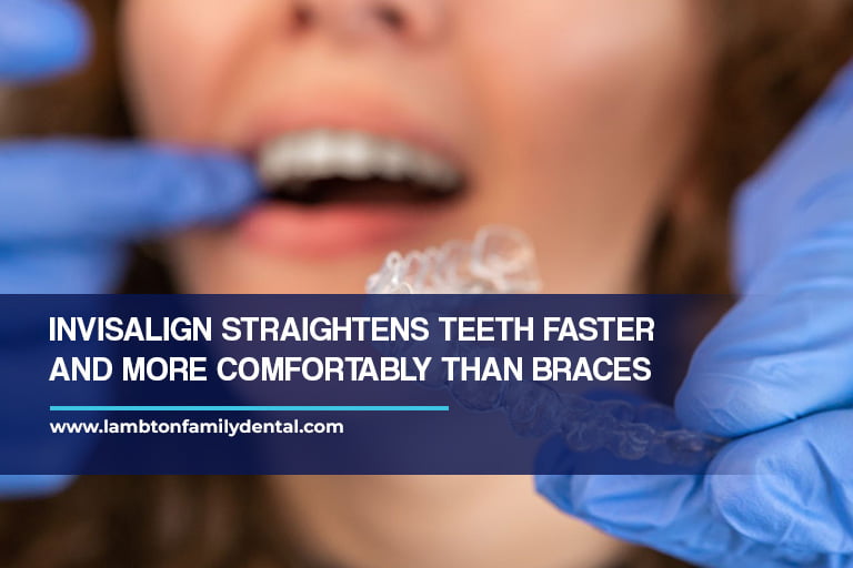 Invisalign straightens teeth faster and more comfortably than braces