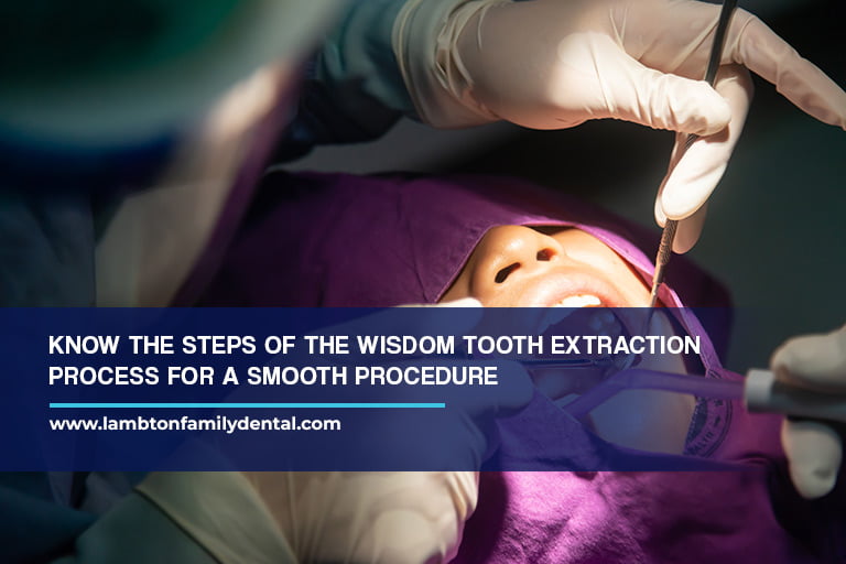 Know the steps of the wisdom tooth extraction process for a smooth procedure