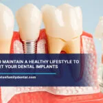 How-to-Maintain-a-Healthy-Lifestyle-to-Support-Your-Dental-Implants