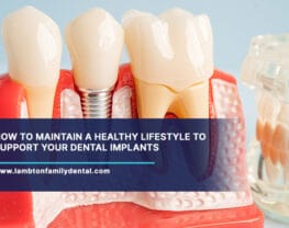 How-to-Maintain-a-Healthy-Lifestyle-to-Support-Your-Dental-Implants