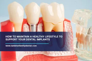 How-to-Maintain-a-Healthy-Lifestyle-to-Support-Your-Dental-Implants