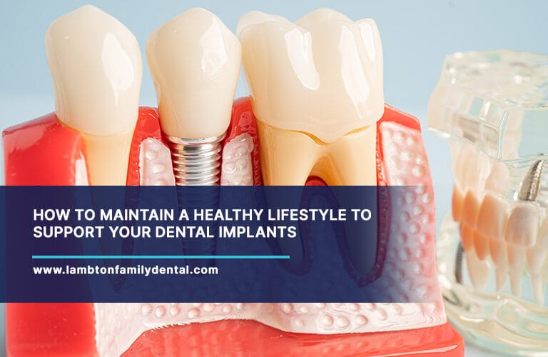 How-to-Maintain-a-Healthy-Lifestyle-to-Support-Your-Dental-Implants