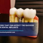 10-Factors-That-Can-Affect-the-Success-of-Your-Dental-Implants