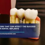 10-Factors-That-Can-Affect-the-Success-of-Your-Dental-Implants