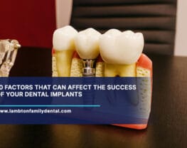 10-Factors-That-Can-Affect-the-Success-of-Your-Dental-Implants