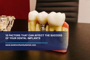 10-Factors-That-Can-Affect-the-Success-of-Your-Dental-Implants