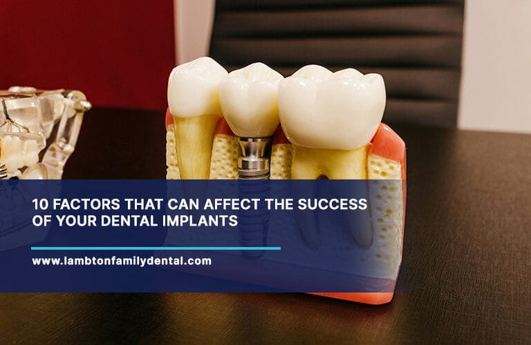 10-Factors-That-Can-Affect-the-Success-of-Your-Dental-Implants