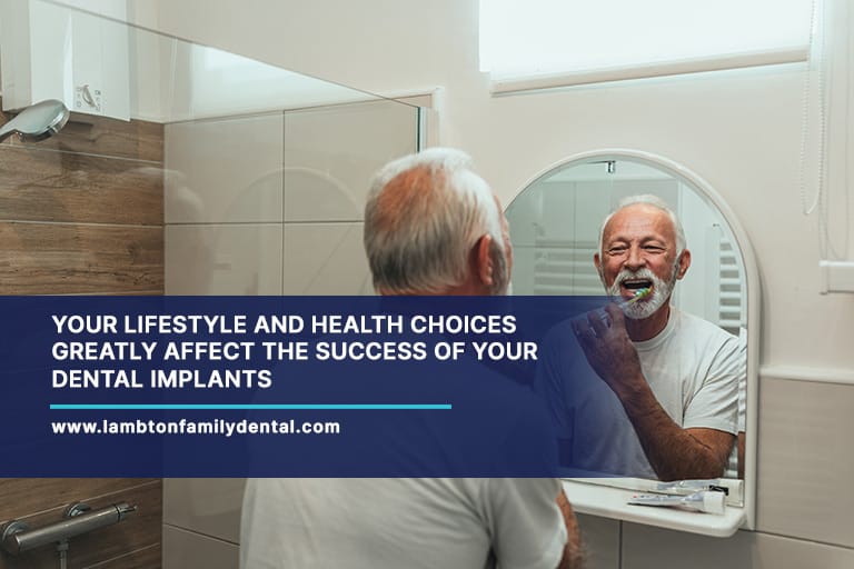 Your-lifestyle-and-health-choices-greatly-affect-the-success-of-your-dental-implants