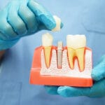 Your-2025-Guide-to-Minimally-Invasive-Dental-Implants