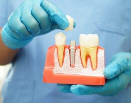 Your-2025-Guide-to-Minimally-Invasive-Dental-Implants