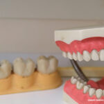 9-Tips-for-Talking-Clearly-While-Wearing-Dentures