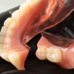 9-Everyday-Habits-That-Can-Damage-Your-Dentures
