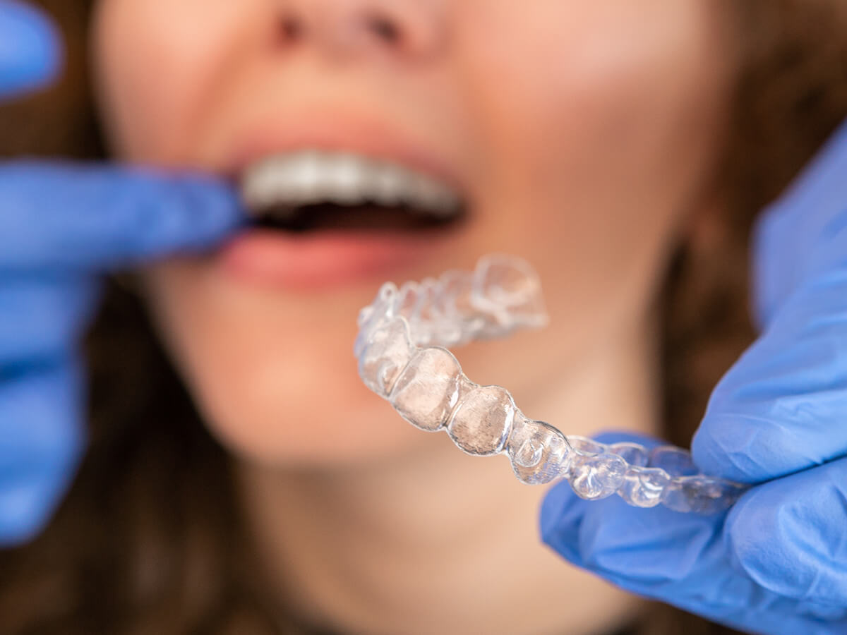 Achieve-Faster-Results-with-Invisalign-in-Sarnia-at-Lambton-Family-Dental