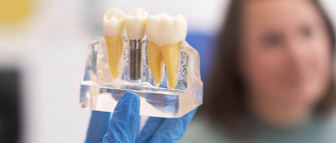 How-to-Transition-from-Dentures-to-Dental-Implants-Smoothly-and-Comfortably