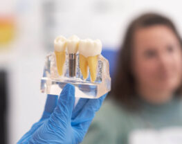 How-to-Transition-from-Dentures-to-Dental-Implants-Smoothly-and-Comfortably