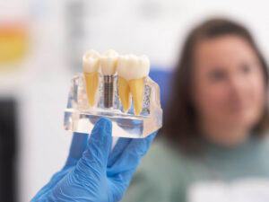 How-to-Transition-from-Dentures-to-Dental-Implants-Smoothly-and-Comfortably