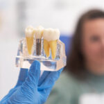 How-to-Prepare-Your-Body-for-Successful-Dental-Implants