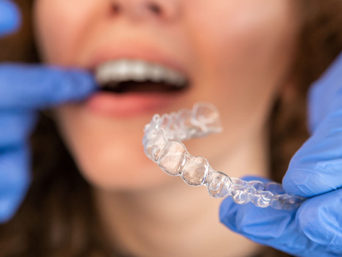 Lock-in-Your-Dream-Smile-with-Invisalign-in-Sarnia-at-Lambton-Family-Dental